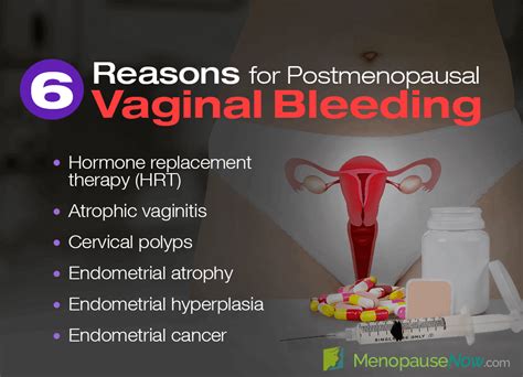 do you bleed when you lose your virginity|Vaginal Bleeding: Causes, Diagnosis & What It Means .